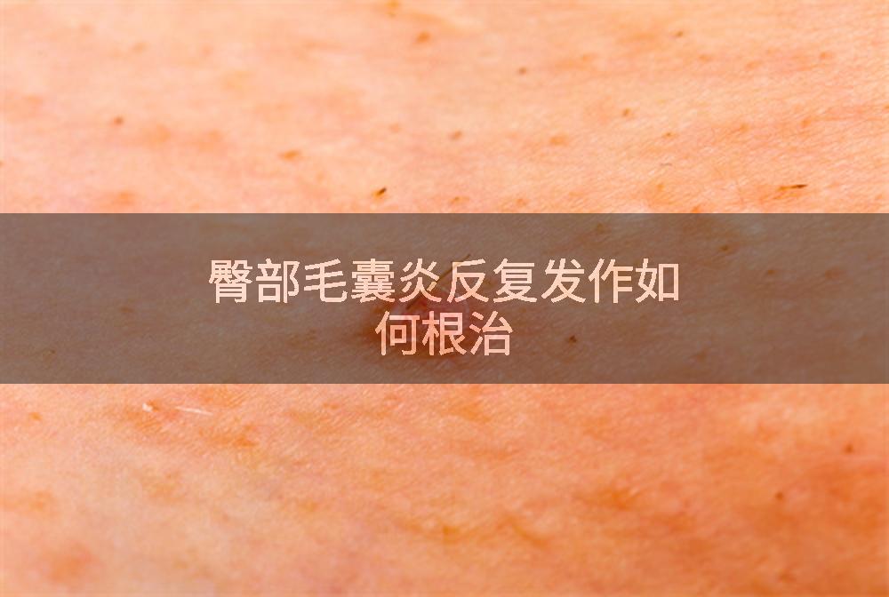 臀部毛囊炎反复发作如何根治