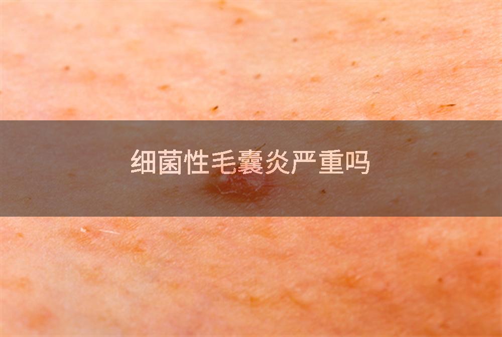 细菌性毛囊炎严重吗