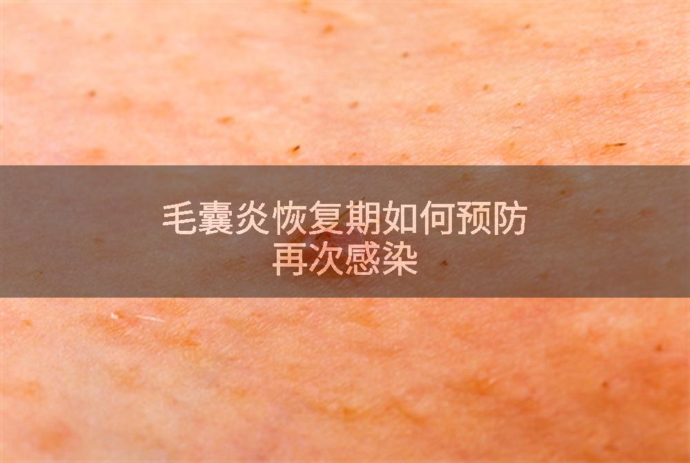 毛囊炎恢复期如何预防再次感染