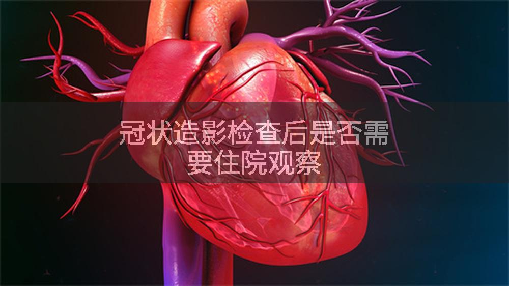 冠状造影检查后是否需要住院观察