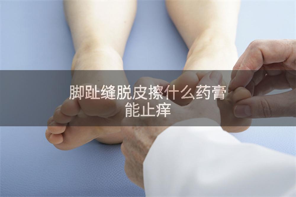 脚趾缝脱皮擦什么药膏能止痒