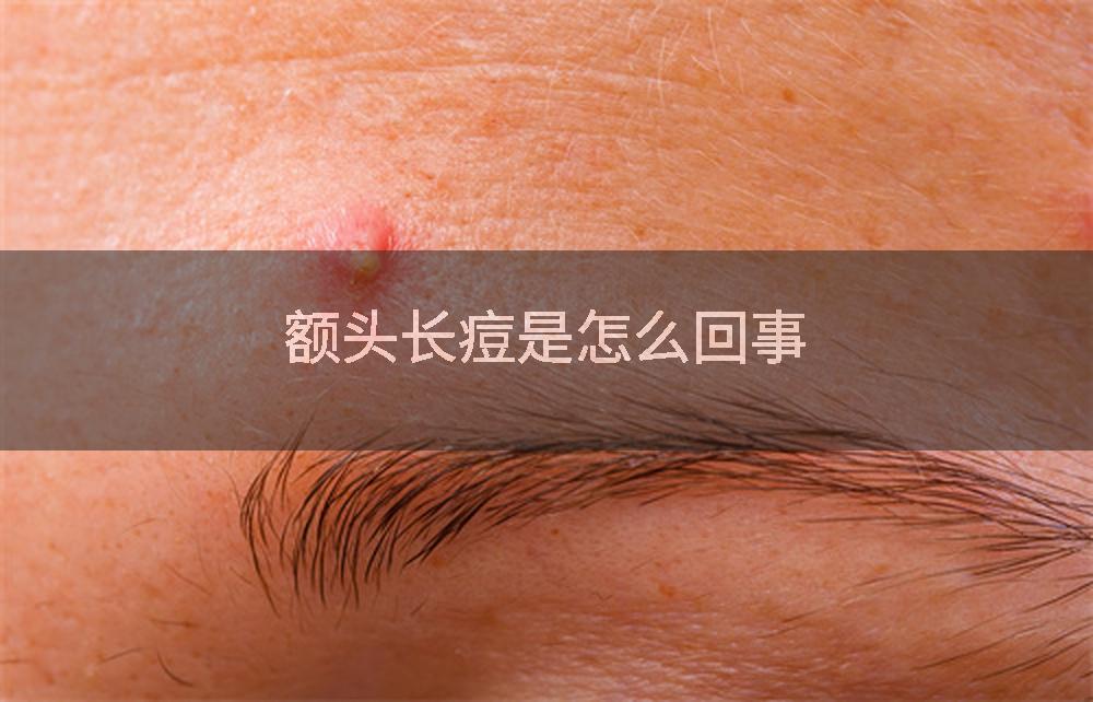 额头长痘是怎么回事