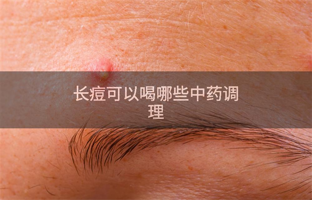 长痘可以喝哪些中药调理