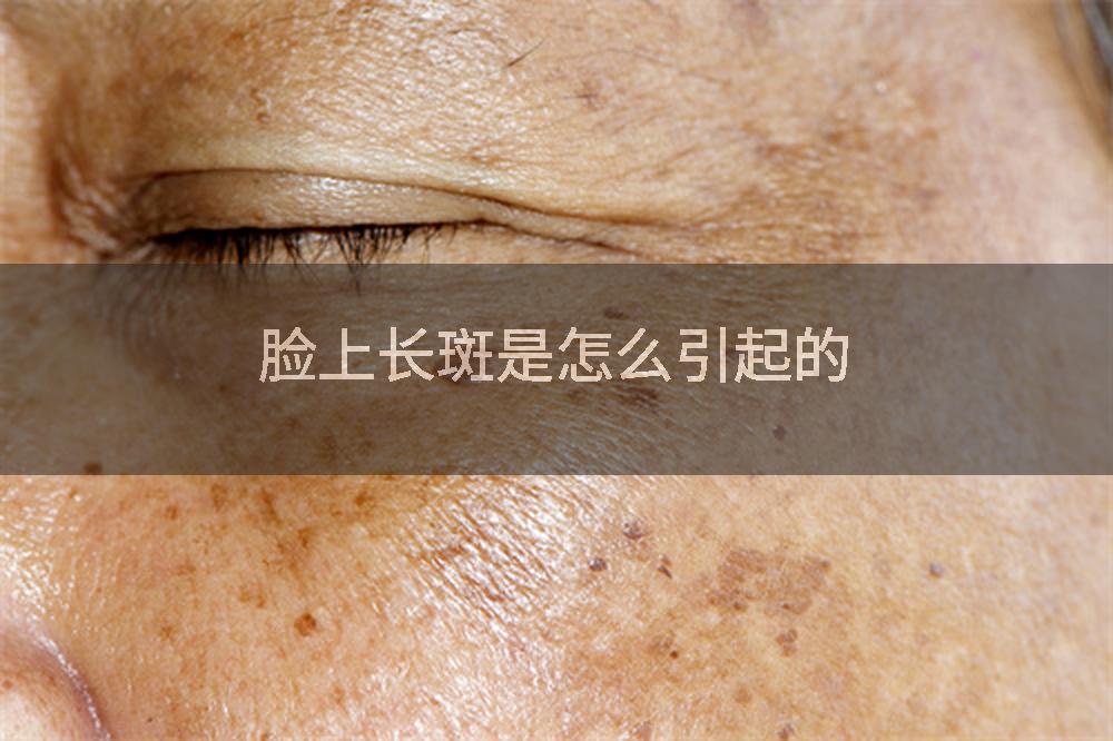 脸上长斑是怎么引起的