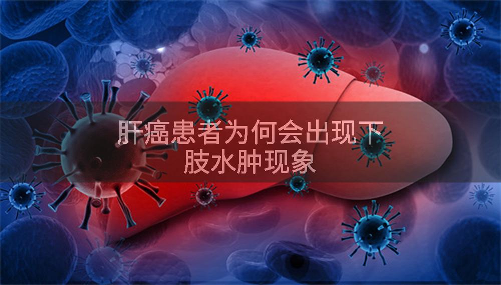 肝癌患者为何会出现下肢水肿现象