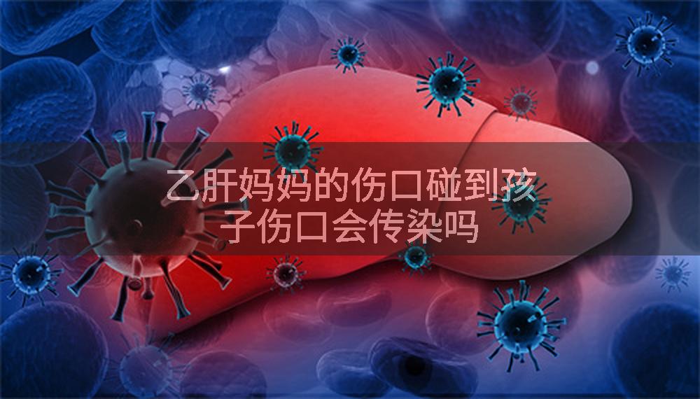 乙肝妈妈的伤口碰到孩子伤口会传染吗