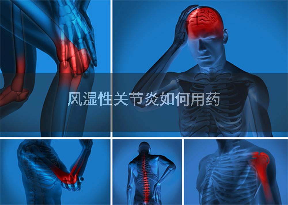 风湿性关节炎如何用药