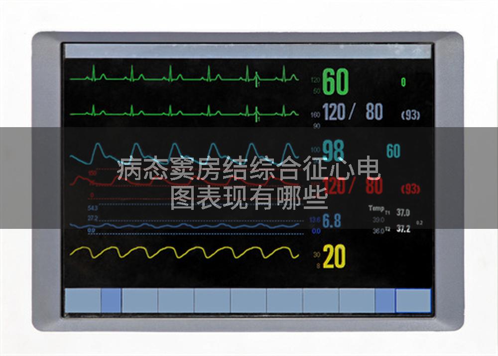 病态窦房结综合征心电图表现有哪些