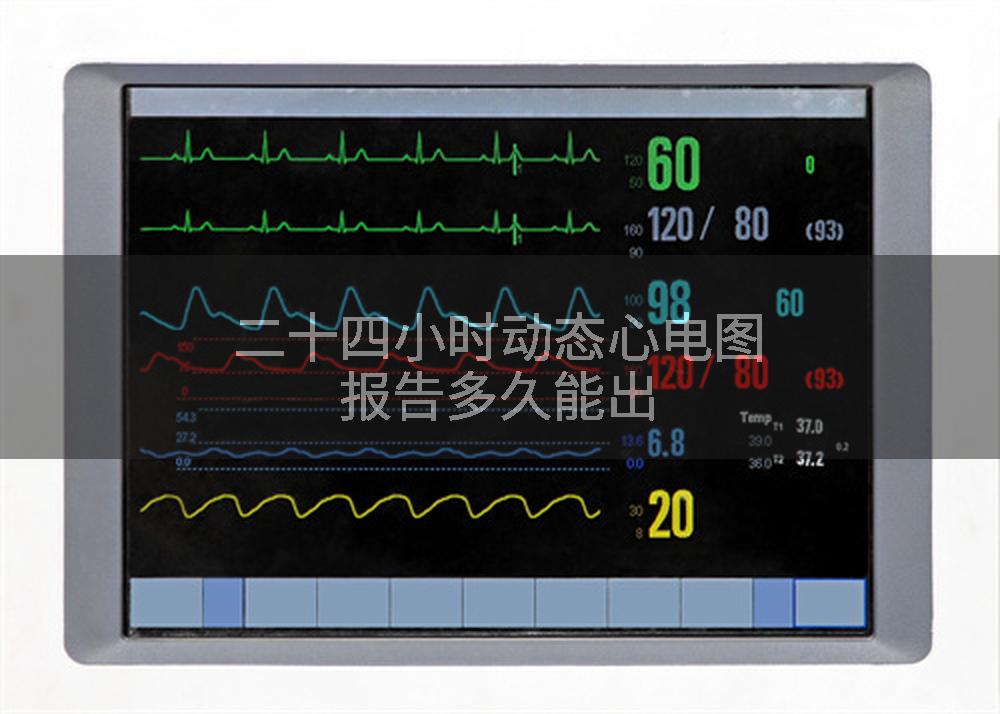 二十四小时动态心电图报告多久能出