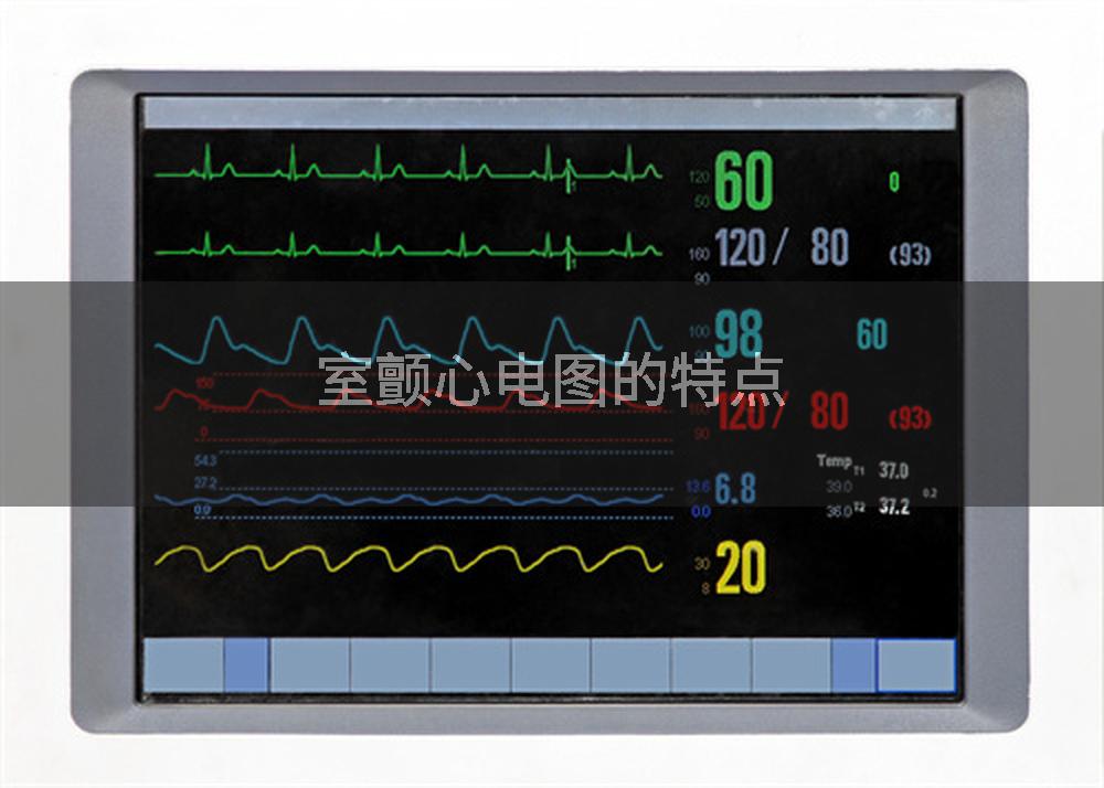 室颤心电图的特点