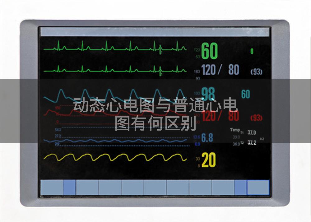 动态心电图与普通心电图有何区别
