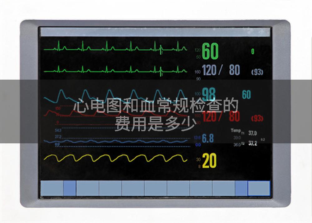 心电图和血常规检查的费用是多少
