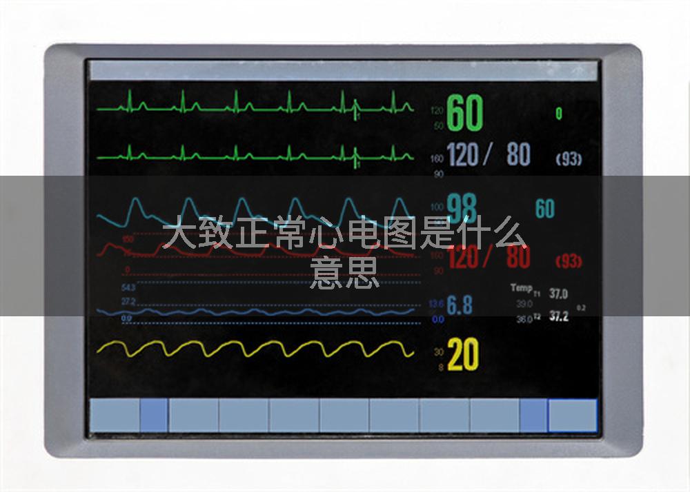 大致正常心电图是什么意思