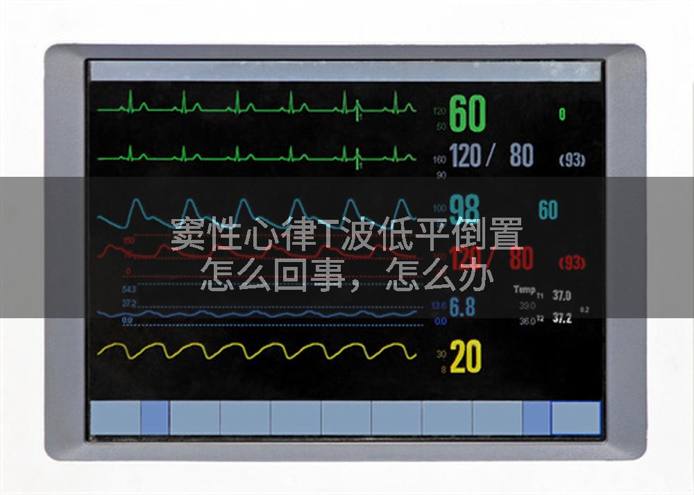 窦性心律T波低平倒置怎么回事，怎么办