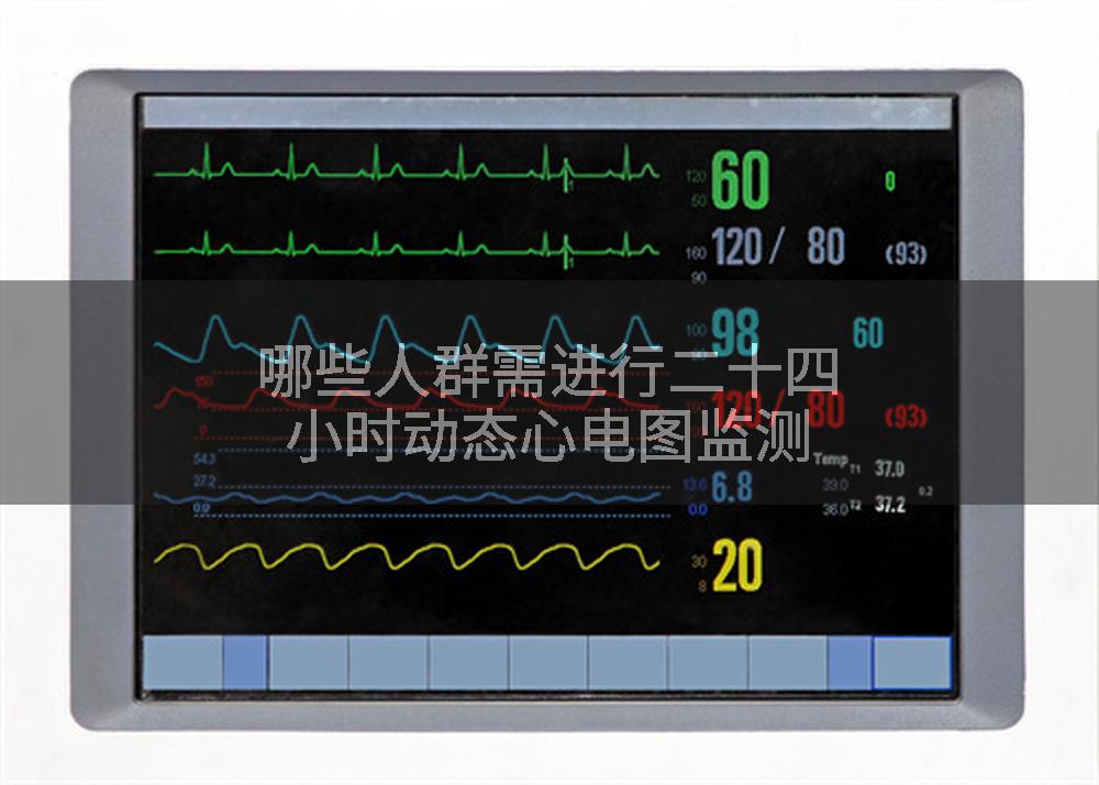 哪些人群需进行二十四小时动态心电图监测
