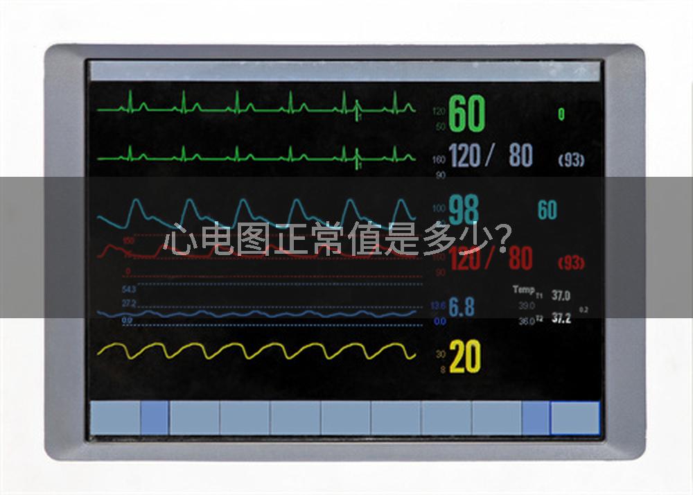 心电图正常值是多少?