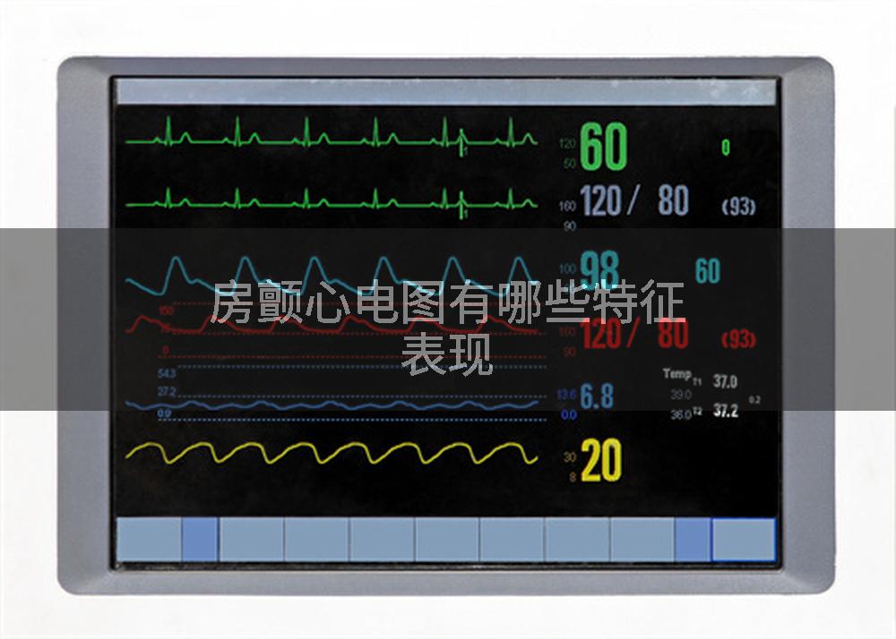 房颤心电图有哪些特征表现