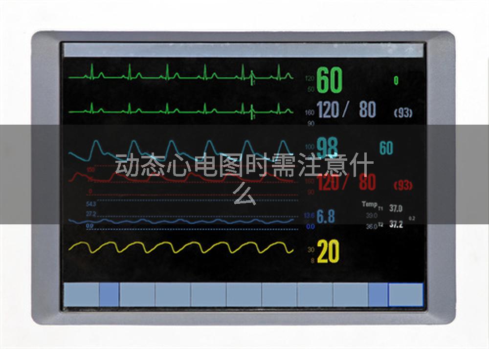 动态心电图时需注意什么