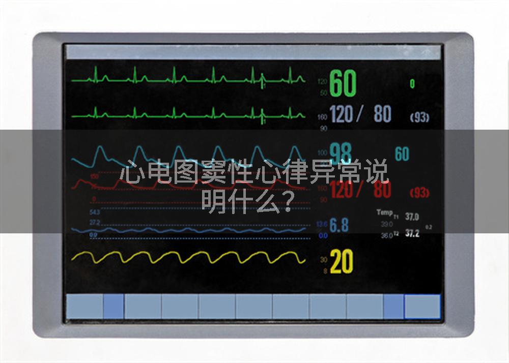 心电图窦性心律异常说明什么？