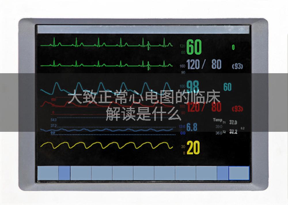 大致正常心电图的临床解读是什么