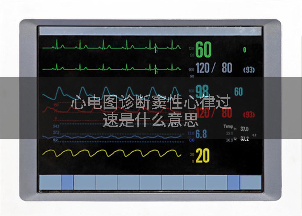 心电图诊断窦性心律过速是什么意思