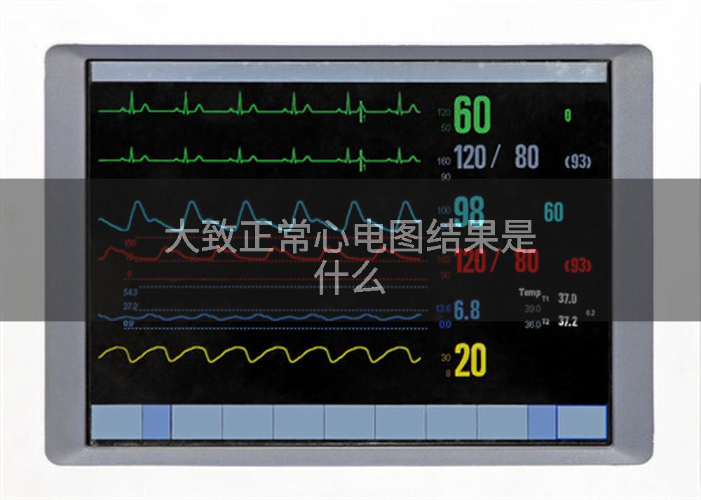 大致正常心电图结果是什么