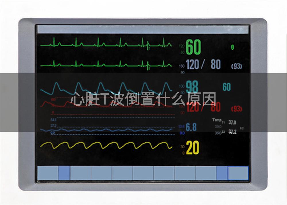 心脏T波倒置什么原因