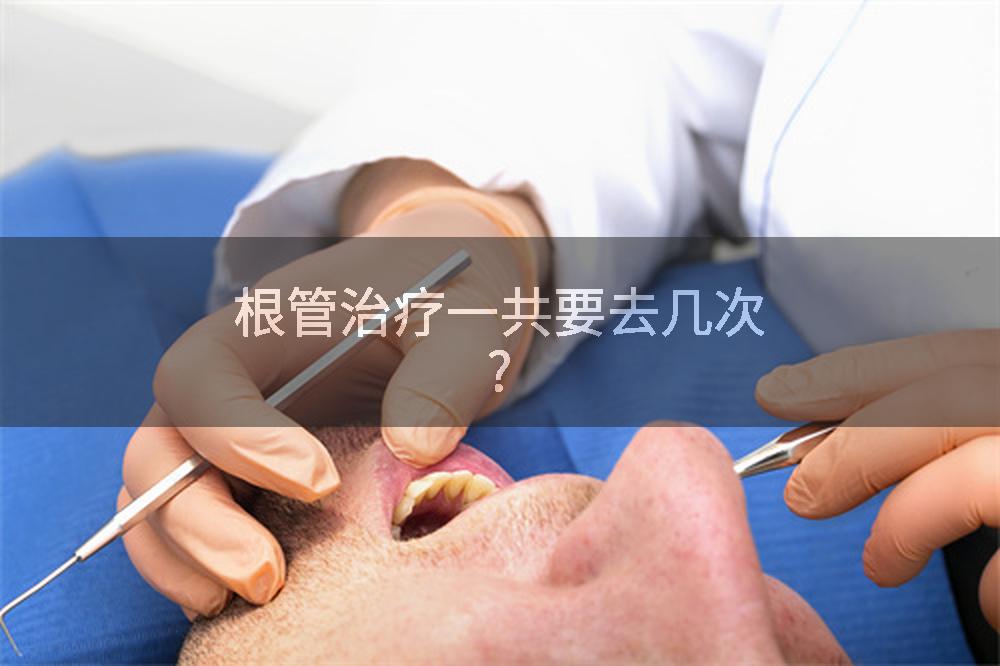 根管治疗一共要去几次?
