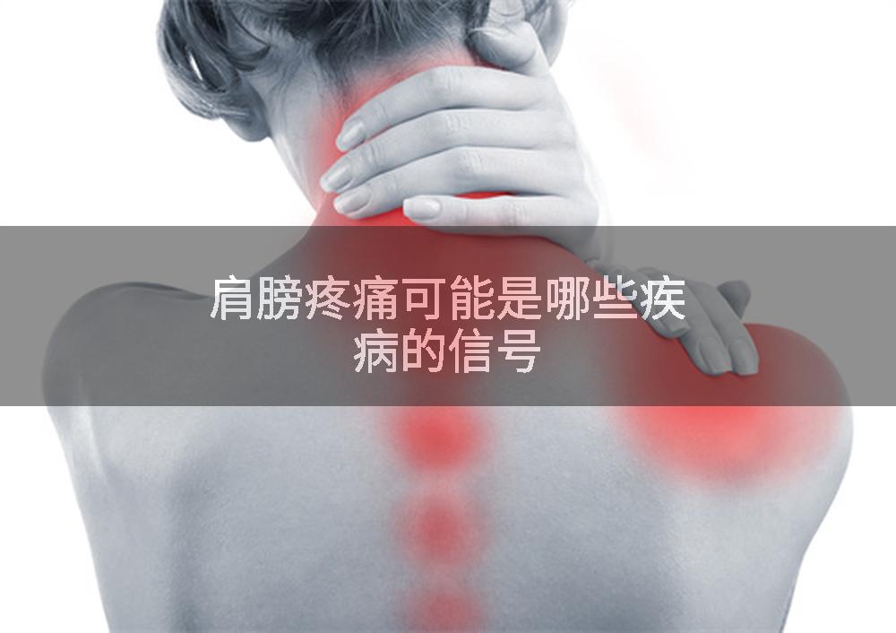 肩膀疼痛可能是哪些疾病的信号