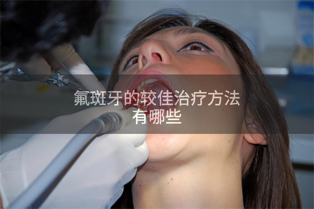 氟斑牙的较佳治疗方法有哪些