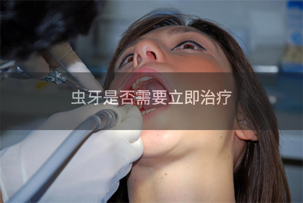 虫牙是否需要立即治疗