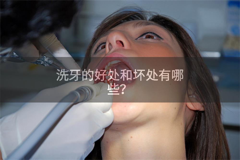 洗牙的好处和坏处有哪些？