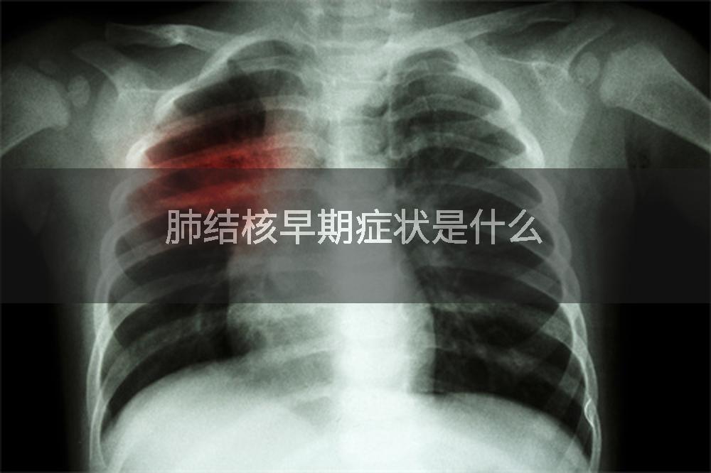 肺结核早期症状是什么