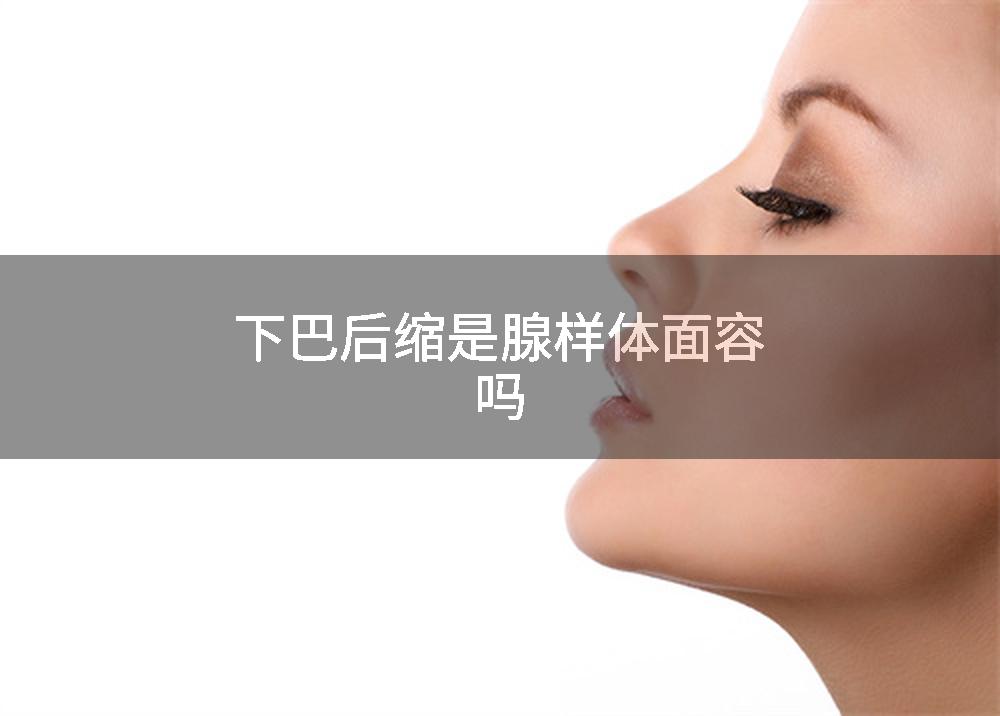 下巴后缩是腺样体面容吗