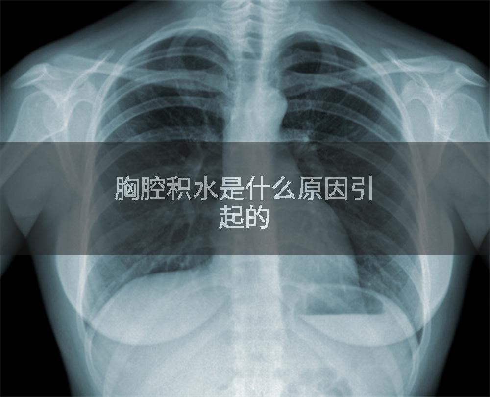 胸腔积水是什么原因引起的