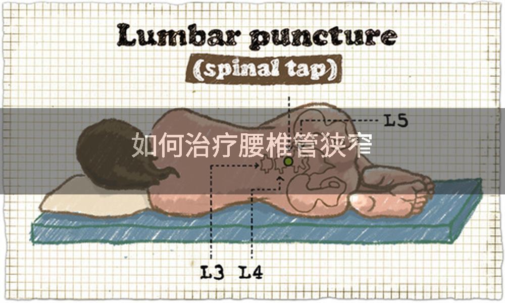 如何治疗腰椎管狭窄