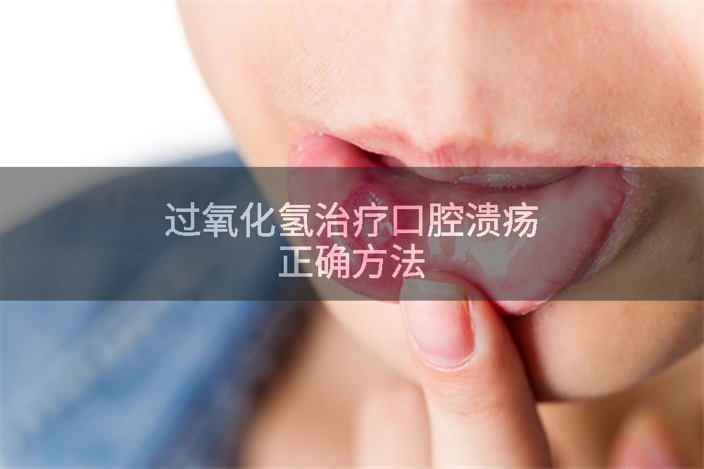 过氧化氢治疗口腔溃疡正确方法