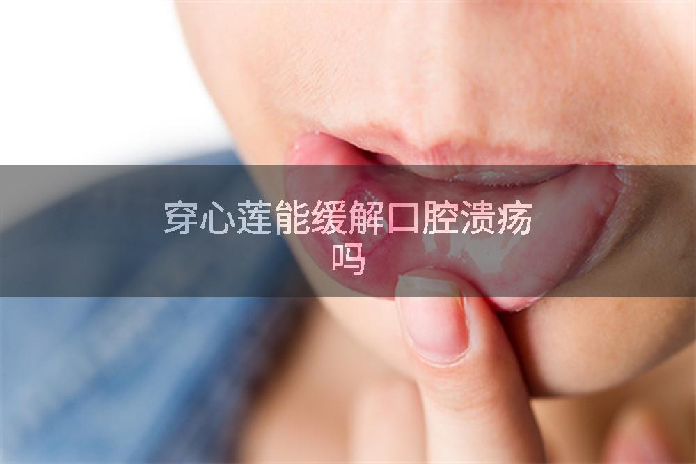穿心莲能缓解口腔溃疡吗