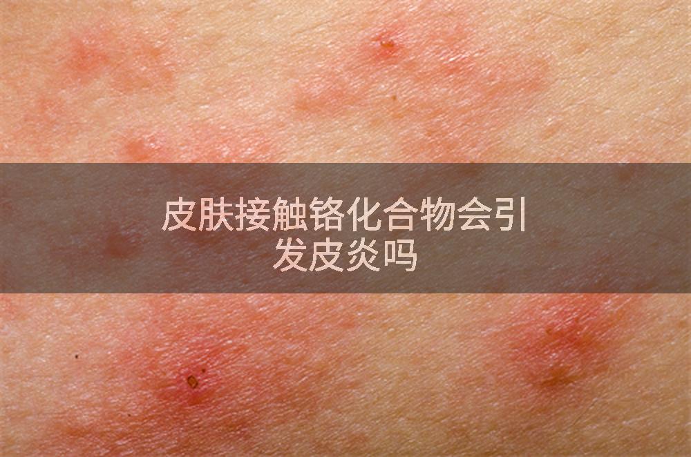 皮肤接触铬化合物会引发皮炎吗