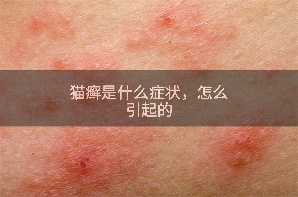 猫癣是什么症状,怎么引起的