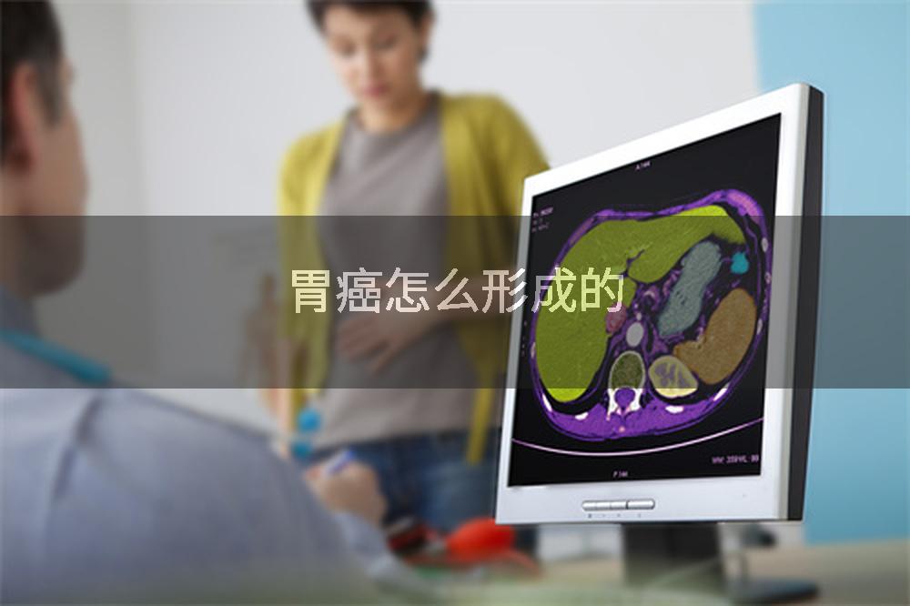 胃癌怎么形成的