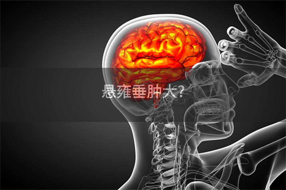 悬雍垂肿大?