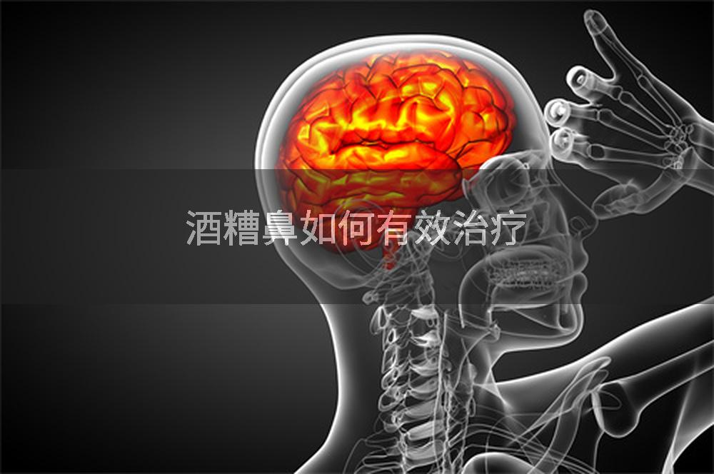 酒糟鼻如何有效治疗