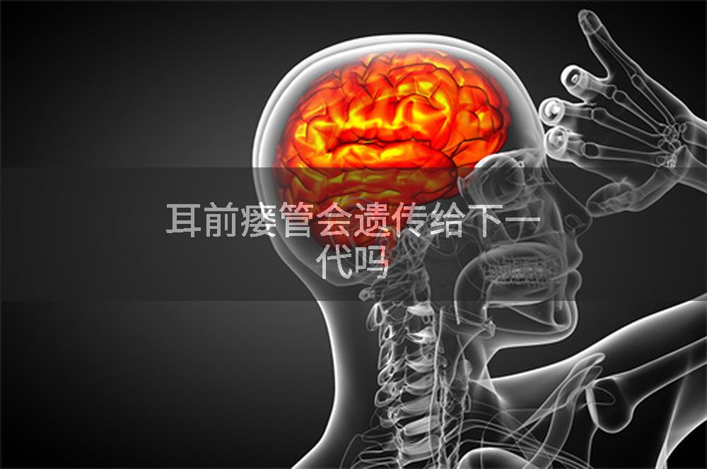 耳前瘘管会遗传给下一代吗