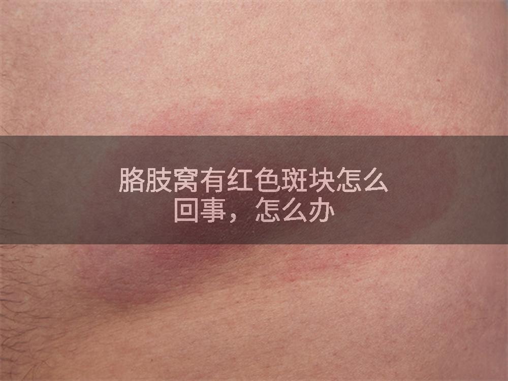 胳肢窝有红色斑块怎么回事，怎么办