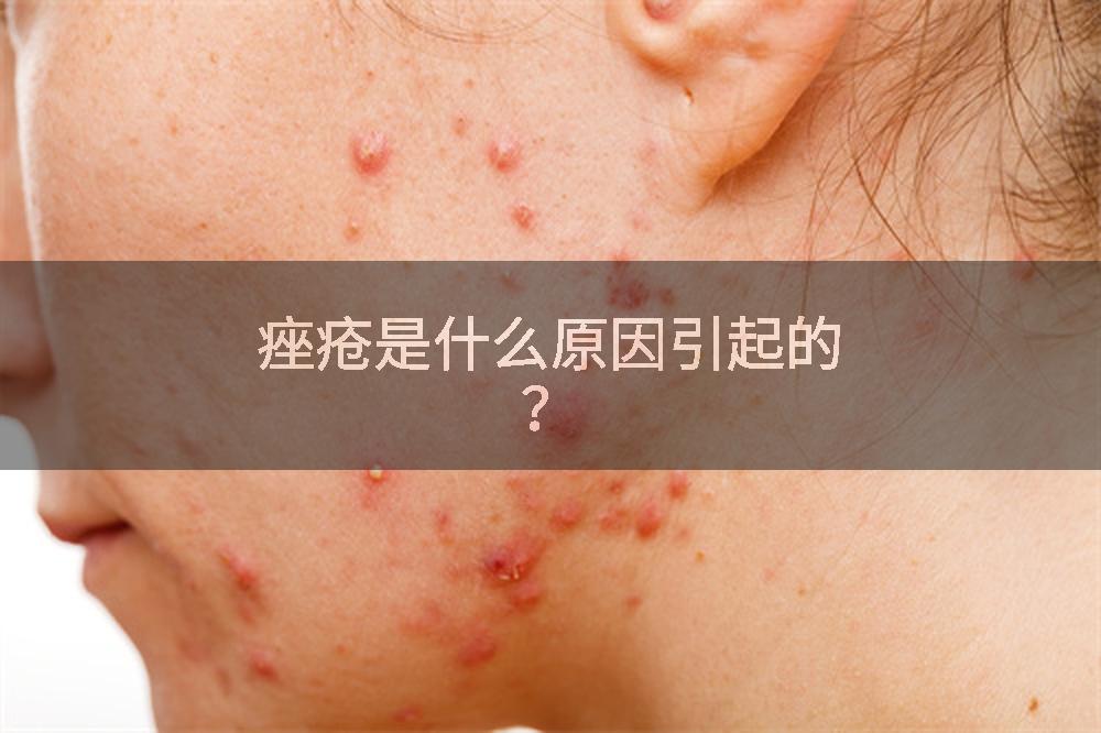 痤疮是什么原因引起的？