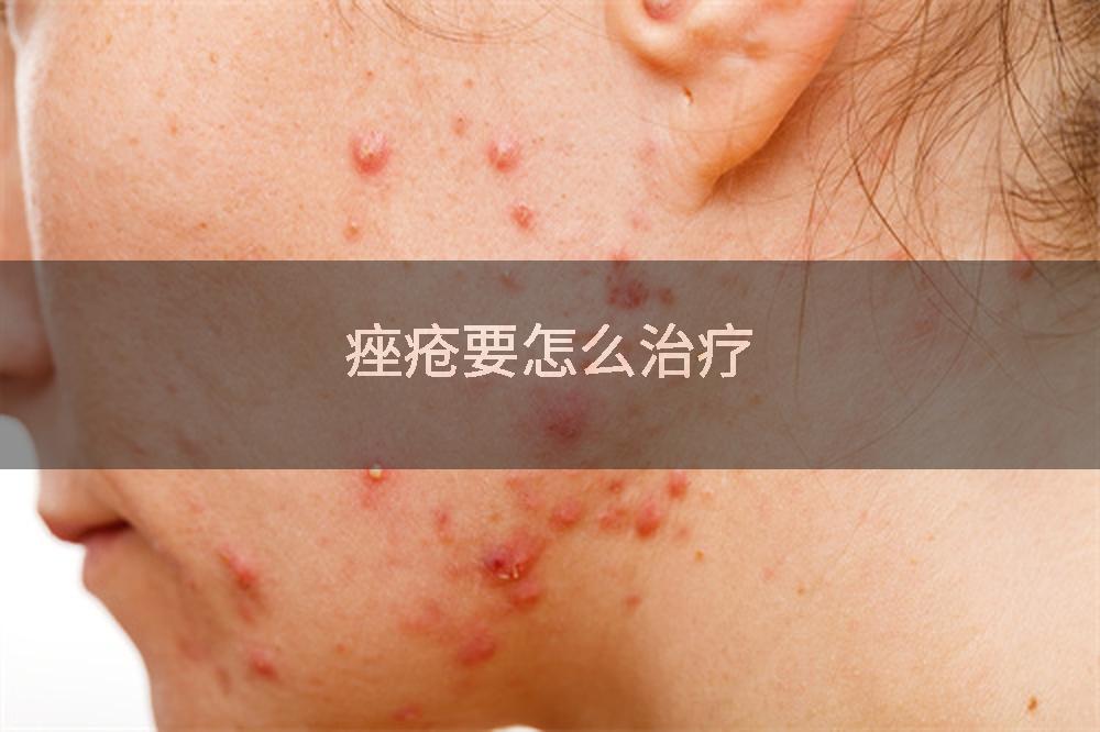 痤疮要怎么治疗