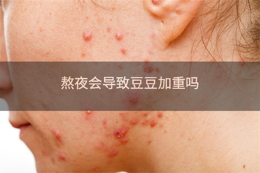 熬夜会导致豆豆加重吗