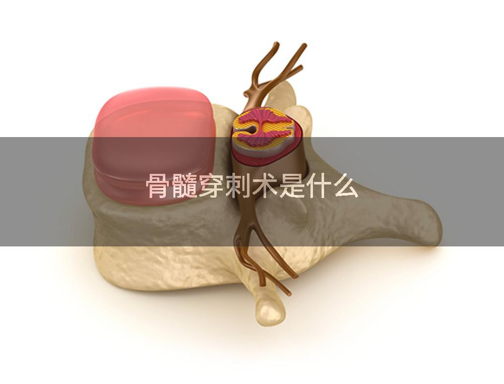 骨髓穿刺术是什么