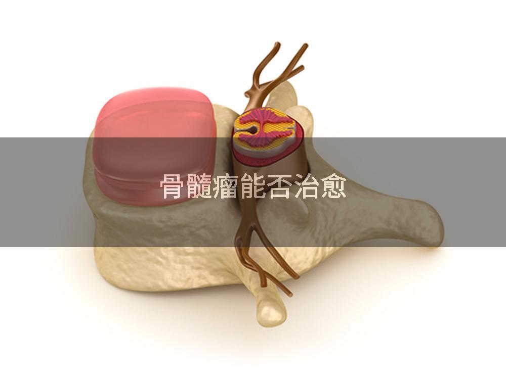 骨髓瘤能否治愈